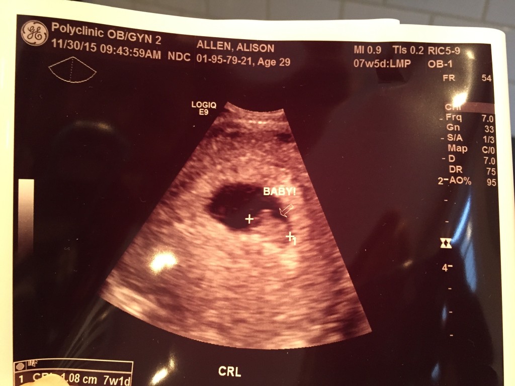{First ultrasound at 8 weeks!}