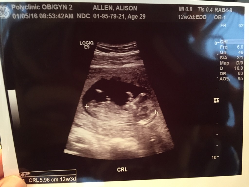 {Second ultrasound at 13 weeks. So amazing to see the changes!}